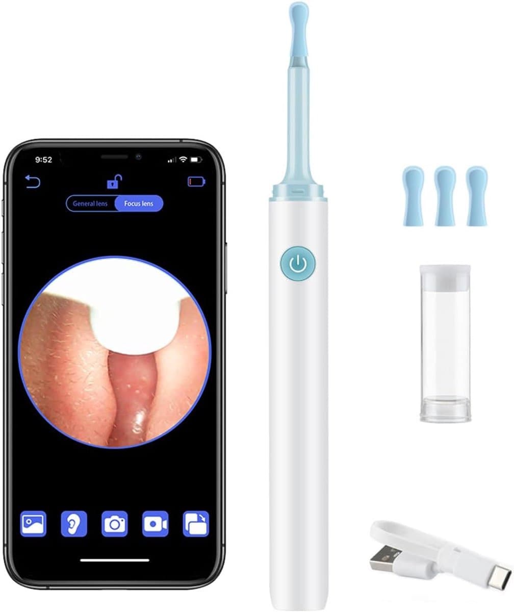 Oorsmeerverwijderaar Otoscoop - Oorreiniger Wifi - Oren Inspecteren - 360° Groothoek HD - 6 LED's - Wit