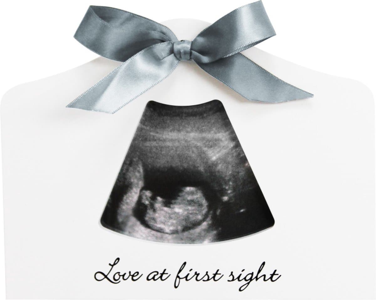 Happy Hands - Sonogram Echo Frame - Fotolijst - Echofoto - Wit