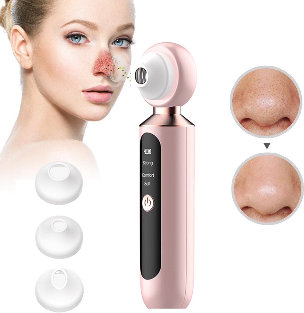 CHIWIN Poriënreiniger – Blackhead Remover met Vacuüm Technologie – 5 Modi – 3 Verwisselbare Opzetstukken – LED Verlichting en Vergrootglas – Roze